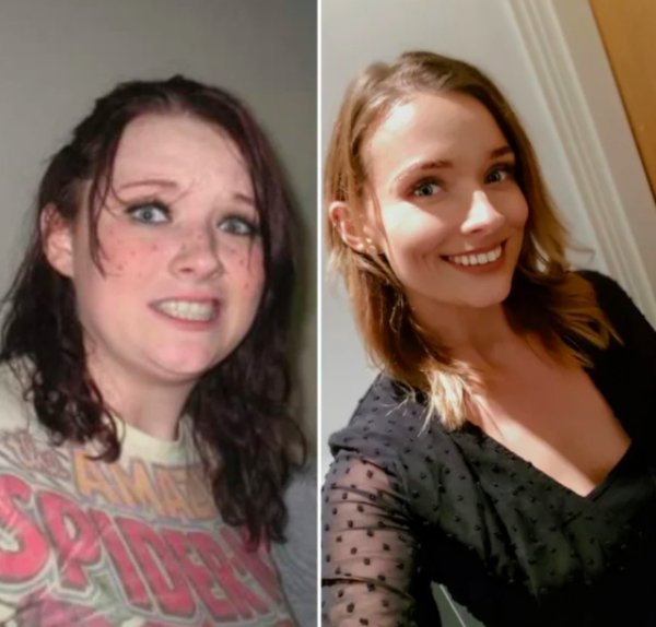 Girls Show Their Dramatic Changes (24 pics)