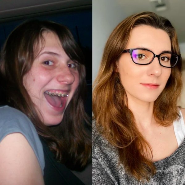 Girls Show Their Dramatic Changes (24 pics)
