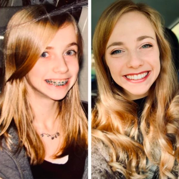 Girls Show Their Dramatic Changes (24 pics)