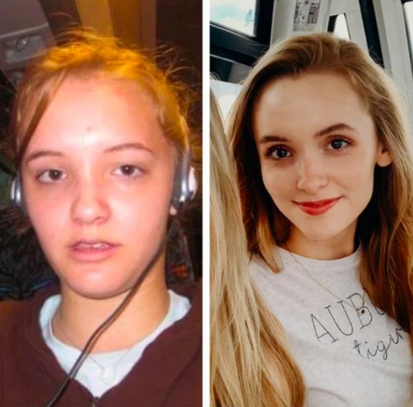 Girls Show Their Dramatic Changes (24 pics)