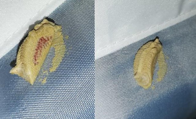 What Are These Things For? (20 pics)