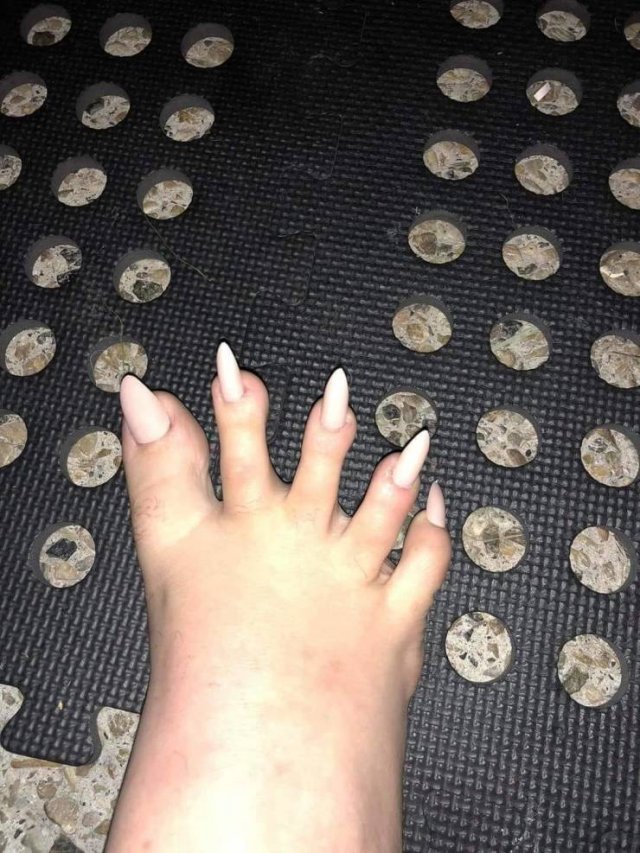 Acid Picdump. Part 1 (94 pics)