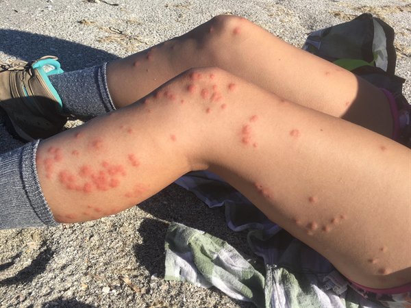Bad Days Happen (26 pics)