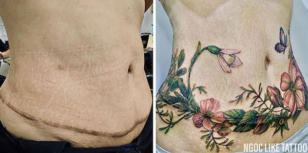 Tattoo Artist Turns Scars And Birthmarks Into Beautiful Art (33 pics)