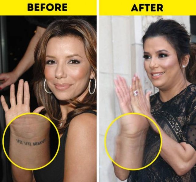 19 Celebrities Who Have Had Their Tattoos Removed Gla