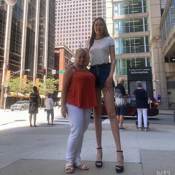 This Girl Has The World's Longest Legs (15 pics)