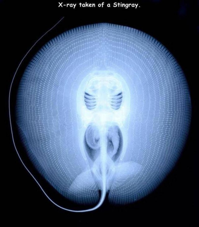 Acid Picdump. Part 2 (94 pics)
