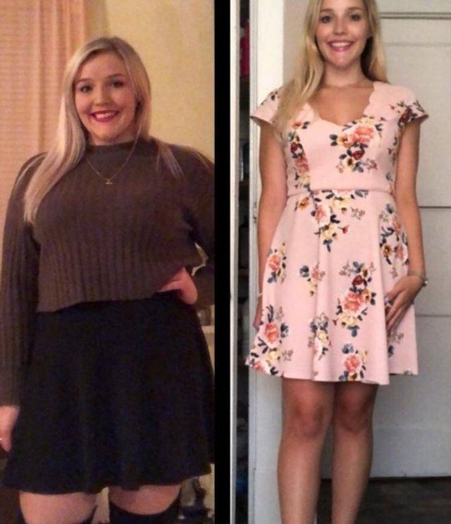 Amazing Weight Loss (44 pics) Amazing Weight Loss (44 pics)
