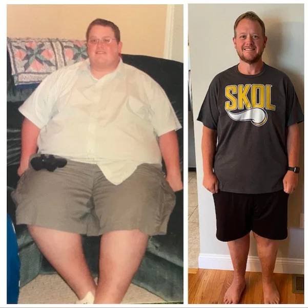 Amazing Weight Loss (44 pics) Amazing Weight Loss (44 pics)