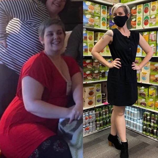 Amazing Weight Loss (44 pics) Amazing Weight Loss (44 pics)