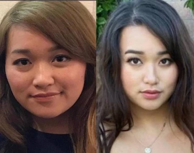 Amazing Weight Loss (44 pics) Amazing Weight Loss (44 pics)
