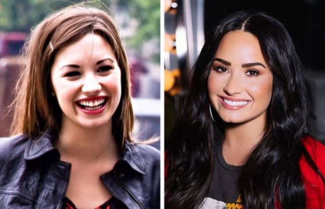 Celebrity Smiles Changes (14 pics) Celebrity Smiles Changes (14 pics)