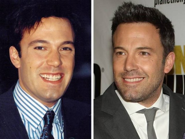 Celebrity Smiles Changes (14 pics) Celebrity Smiles Changes (14 pics)