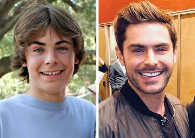 Celebrity Smiles Changes (14 pics) Celebrity Smiles Changes (14 pics)