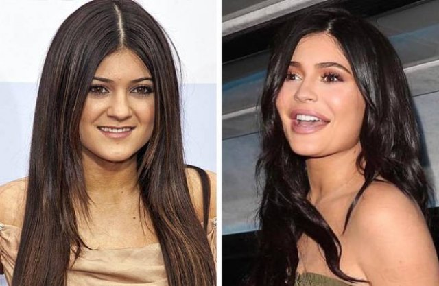 Celebrity Smiles Changes (14 pics)