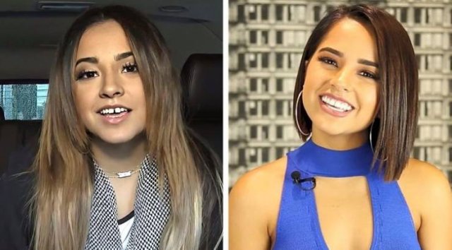 Celebrity Smiles Changes (14 pics) Celebrity Smiles Changes (14 pics)