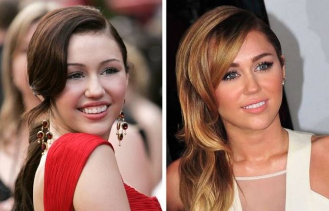 Celebrity Smiles Changes (14 pics) Celebrity Smiles Changes (14 pics)