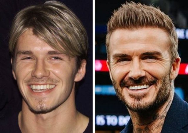Celebrity Smiles Changes (14 pics) Celebrity Smiles Changes (14 pics)