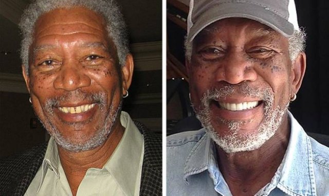 Celebrity Smiles Changes (14 pics) Celebrity Smiles Changes (14 pics)