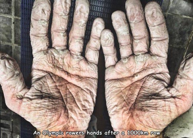 Acid Picdump. Part 2 (96 pics)