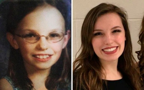 Women Show Off Their Transformations (24 pics)