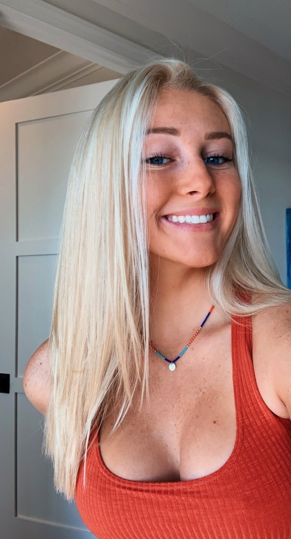 Girls With Freckles (34 pics)