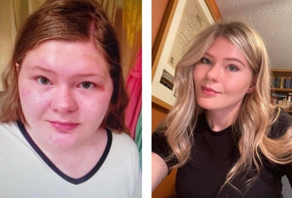 Fantastic Weight Loss (19 pics)