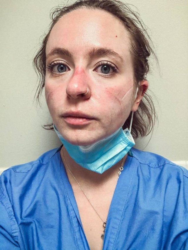 Nurse Shows Her Changes After Nine Months Of Pandemic (12 pics)
