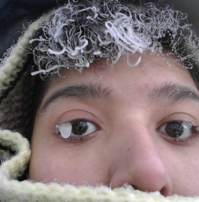 It's Very Cold (20 pics)