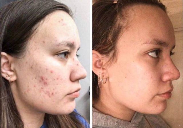 People Show Off Their Transformations (20 pics)