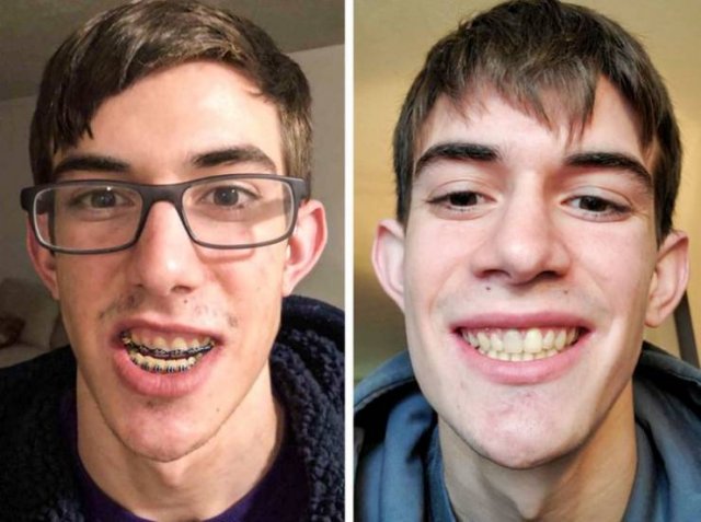 People Show Off Their Transformations (20 pics)
