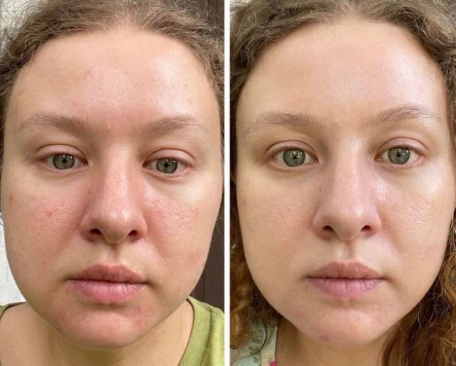 People Show Off Their Transformations (20 pics)