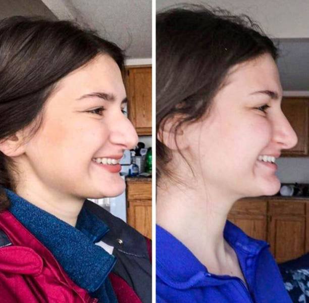 People Show Off Their Transformations (20 pics)