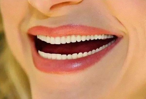 Instagram Vs Reality (32 pics)