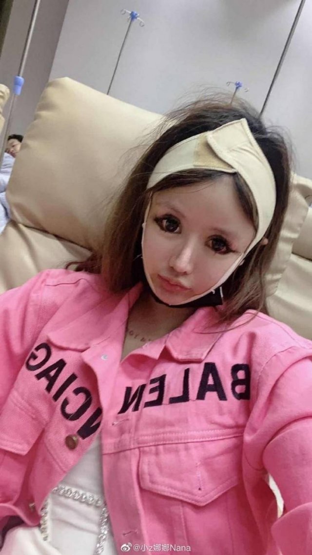 Dramatic Changes Of A 16-Year-Old Schoolgirl After Plastic Surgeries (25 pics)