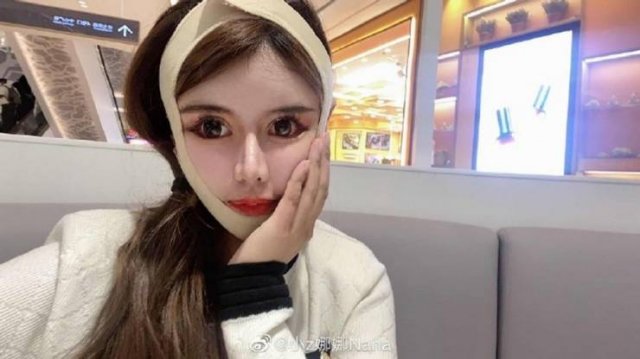 Dramatic Changes Of A 16-Year-Old Schoolgirl After Plastic Surgeries (25 pics)