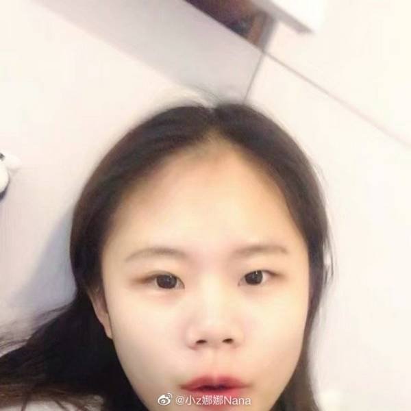 Dramatic Changes Of A 16-Year-Old Schoolgirl After Plastic Surgeries (25 pics)