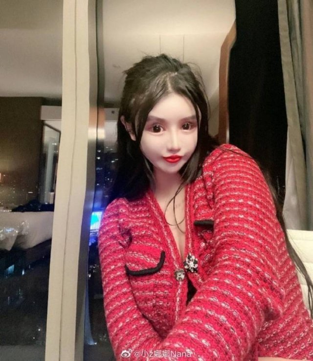 Dramatic Changes Of A 16-Year-Old Schoolgirl After Plastic Surgeries (25 pics)