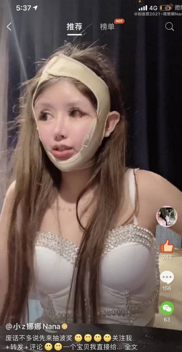 Dramatic Changes Of A 16-Year-Old Schoolgirl After Plastic Surgeries (25 pics)