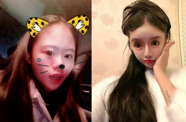 Dramatic Changes Of A 16-Year-Old Schoolgirl After Plastic Surgeries (25 pics)