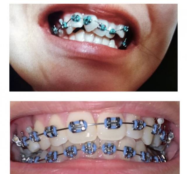 Awesome Before Vs After (18 pics)