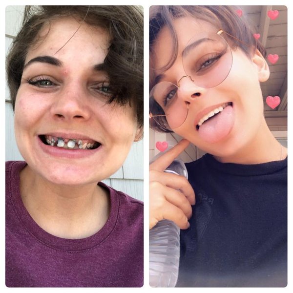 People Show Off Their Transformations (19 pics)