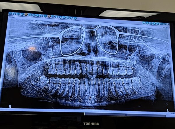 Things Under X-Rays (24 pics)