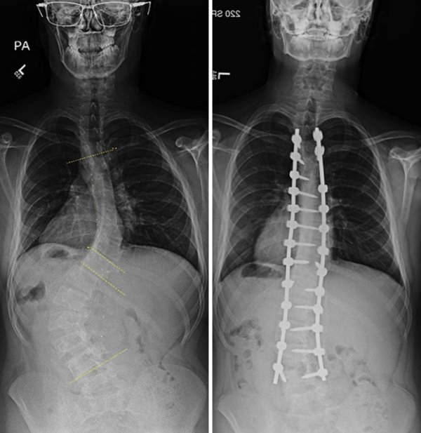 Things Under X-Rays (24 pics)