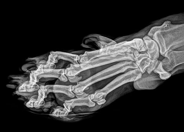 Things Under X-Rays (24 pics)