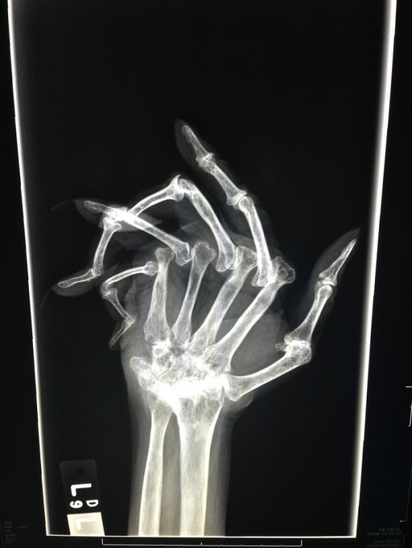 Things Under X-Rays (24 pics)