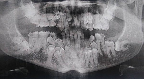 Things Under X-Rays (24 pics)