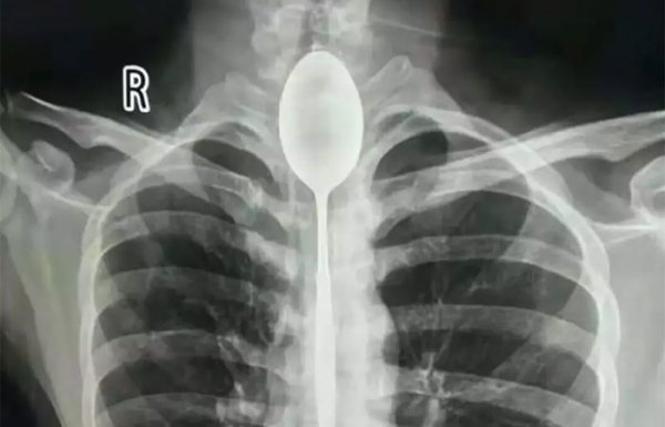 Things Under X-Rays (24 pics)