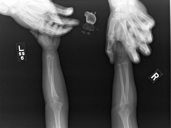 Things Under X-Rays (24 pics)