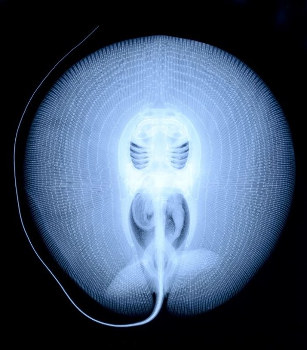 Things Under X-Rays (24 pics)